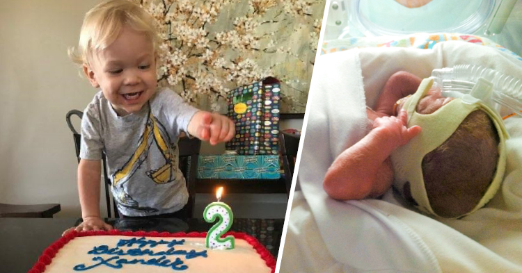 Premature child at birth and at his second birthday